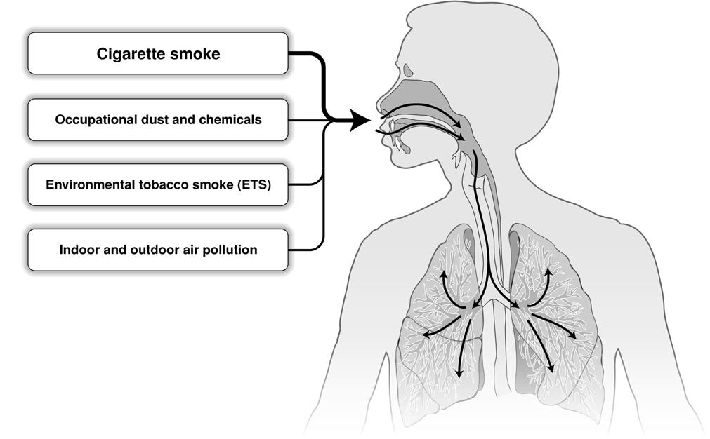 Risk Factors for COPD Genes Infections