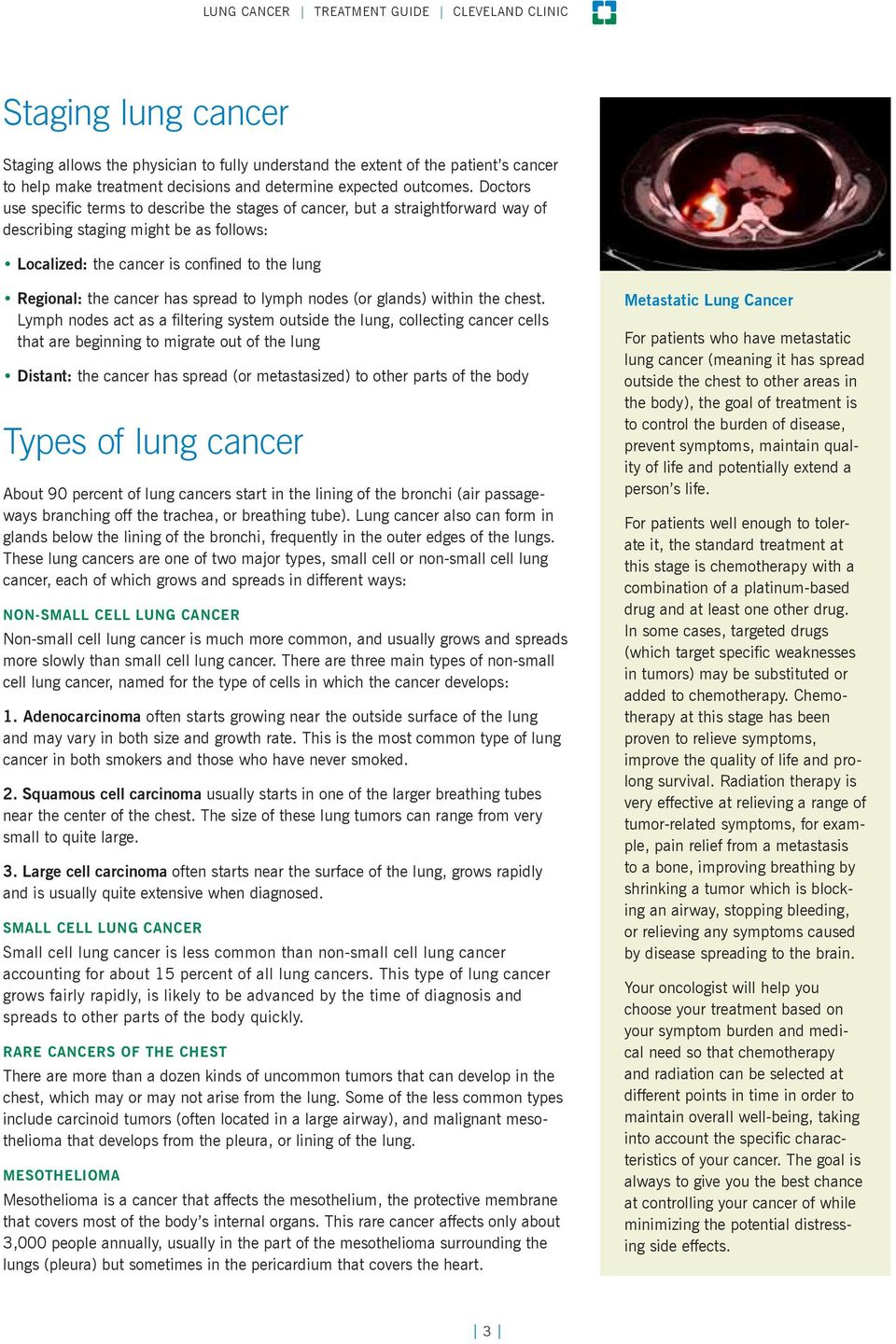 Doctors use specific terms to describe the stages of cancer, but a straightforward way of describing staging might be as follows: Localized: the cancer is confined to the lung Regional: the cancer