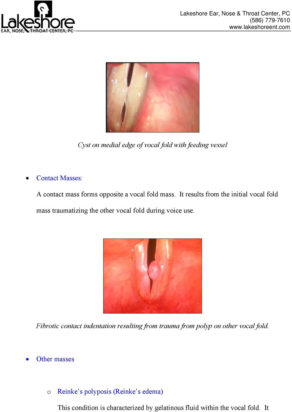 It results from the initial vocal fold mass traumatizing the other vocal fold during voice use.
