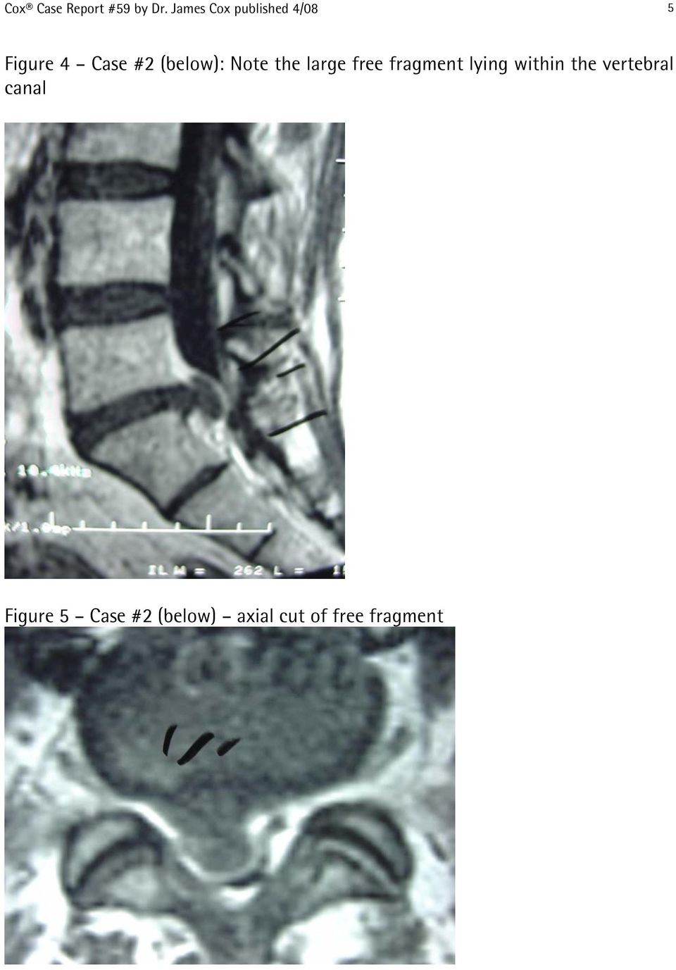 (below): Note the large free fragment lying