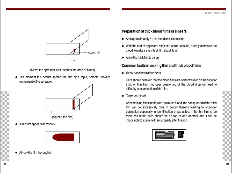 With the end of applicator stick or a corner of slide, quickly distribute the 2 blood to make a even thick film about 1cm Allow the thick film to air dry Common faults in making thin and thick blood