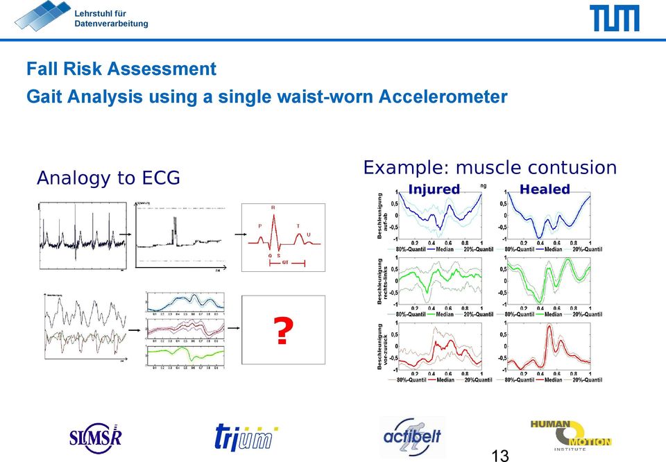 waist-worn Accelerometer Analogy