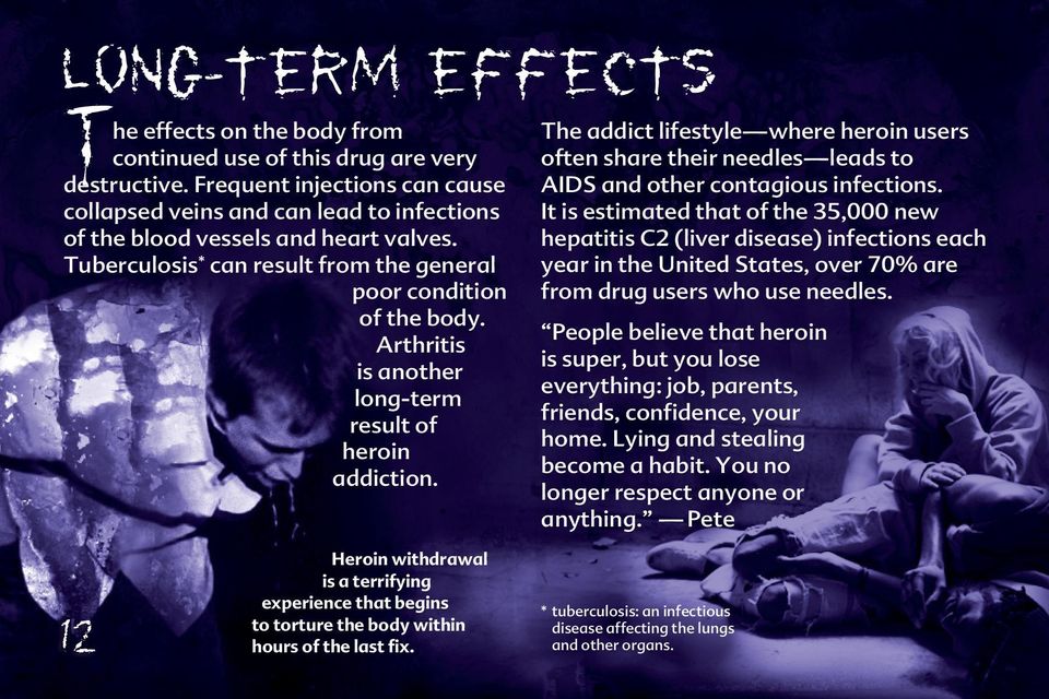 Arthritis is another long term result of heroin addiction. The addict lifestyle where heroin users often share their needles leads to AIDS and other contagious infections.