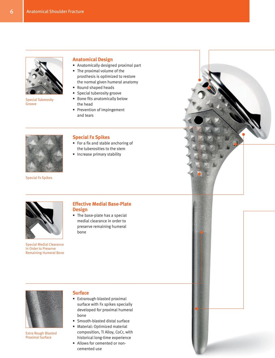 the stem Increase primary stability Special Fx Spikes Effective Medial Base-Plate Design The base-plate has a special medial clearance in order to preserve remaining humeral bone Special Medial