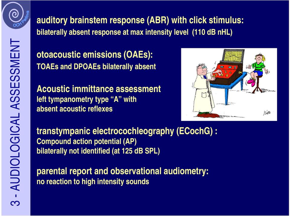 tympanometry type A with absent acoustic reflexes transtympanic electrocochleography (ECochG) : Compound action potential