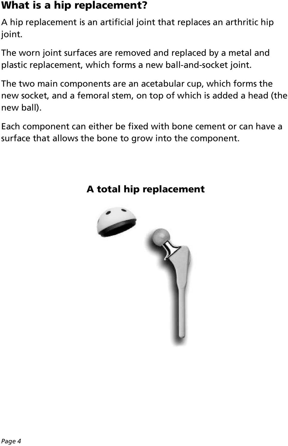 The two main components are an acetabular cup, which forms the new socket, and a femoral stem, on top of which is added a head
