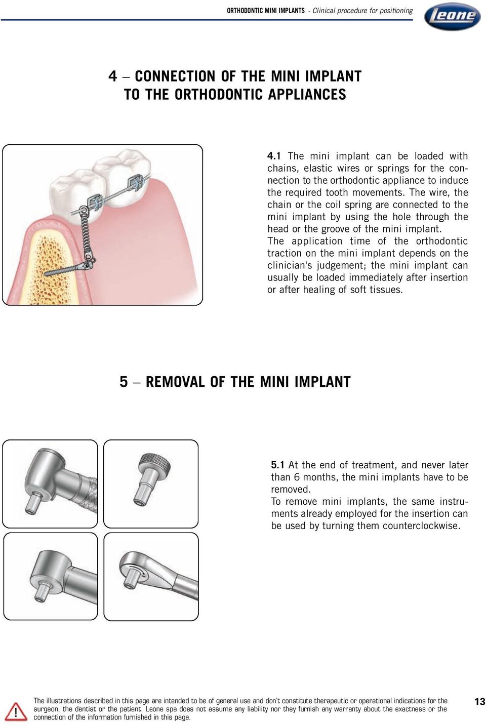 The wire, the chain or the coil spring are connected to the mini implant by using the hole through the head or the groove of the mini implant.