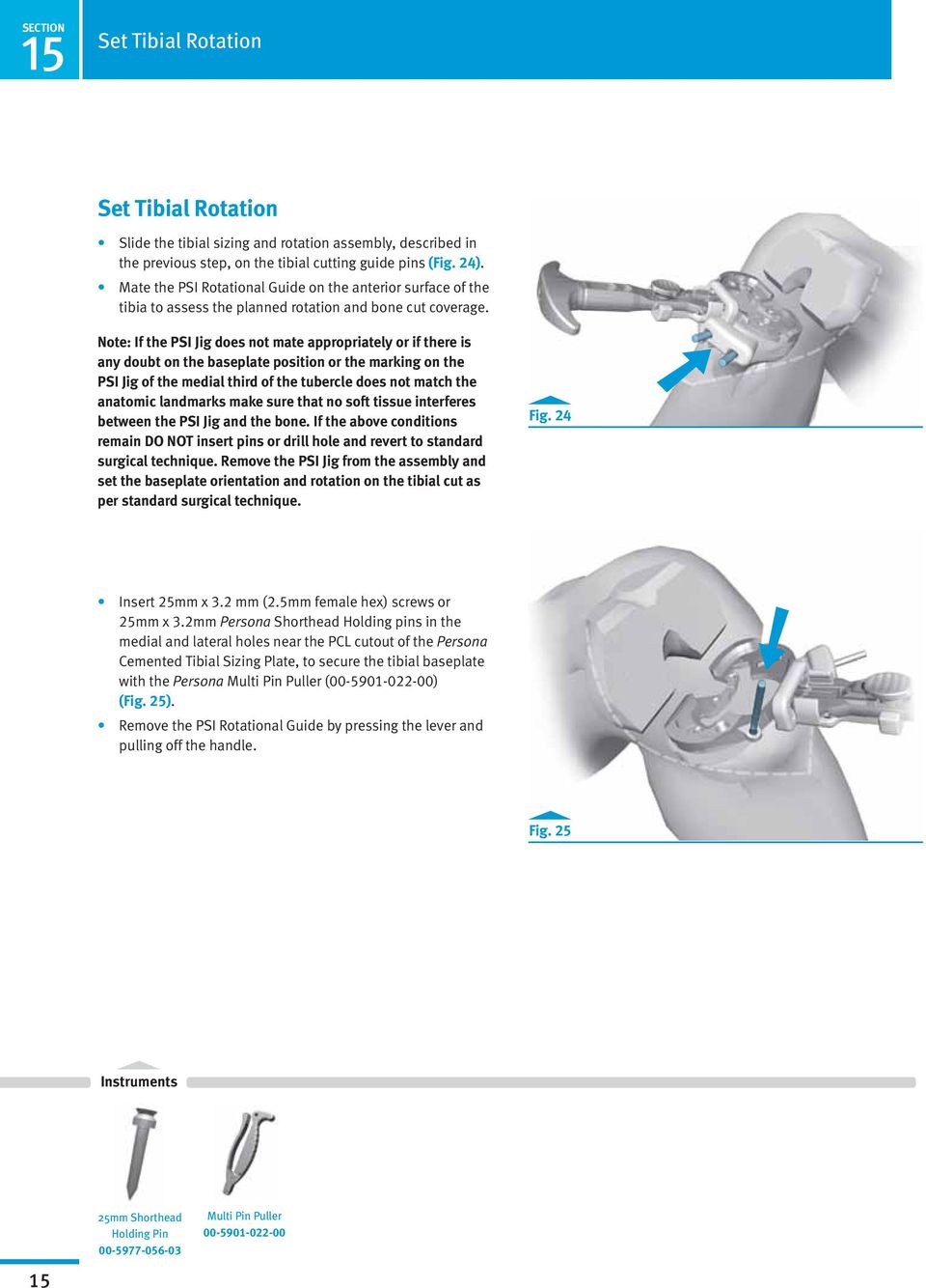Note: If the PSI Jig does not mate appropriately or if there is any doubt on the baseplate position or the marking on the PSI Jig of the medial third of the tubercle does not match the anatomic