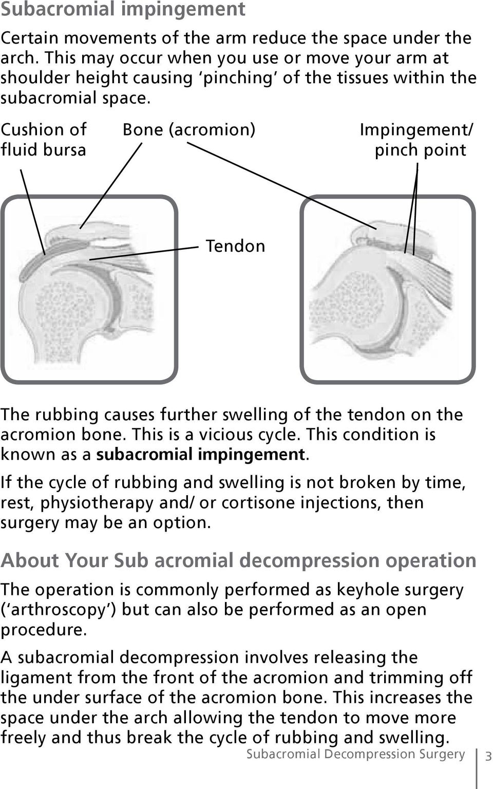 Cushion of Bone (acromion) Impingement/ fluid bursa pinch point Tendon The rubbing causes further swelling of the tendon on the acromion bone. This is a vicious cycle.