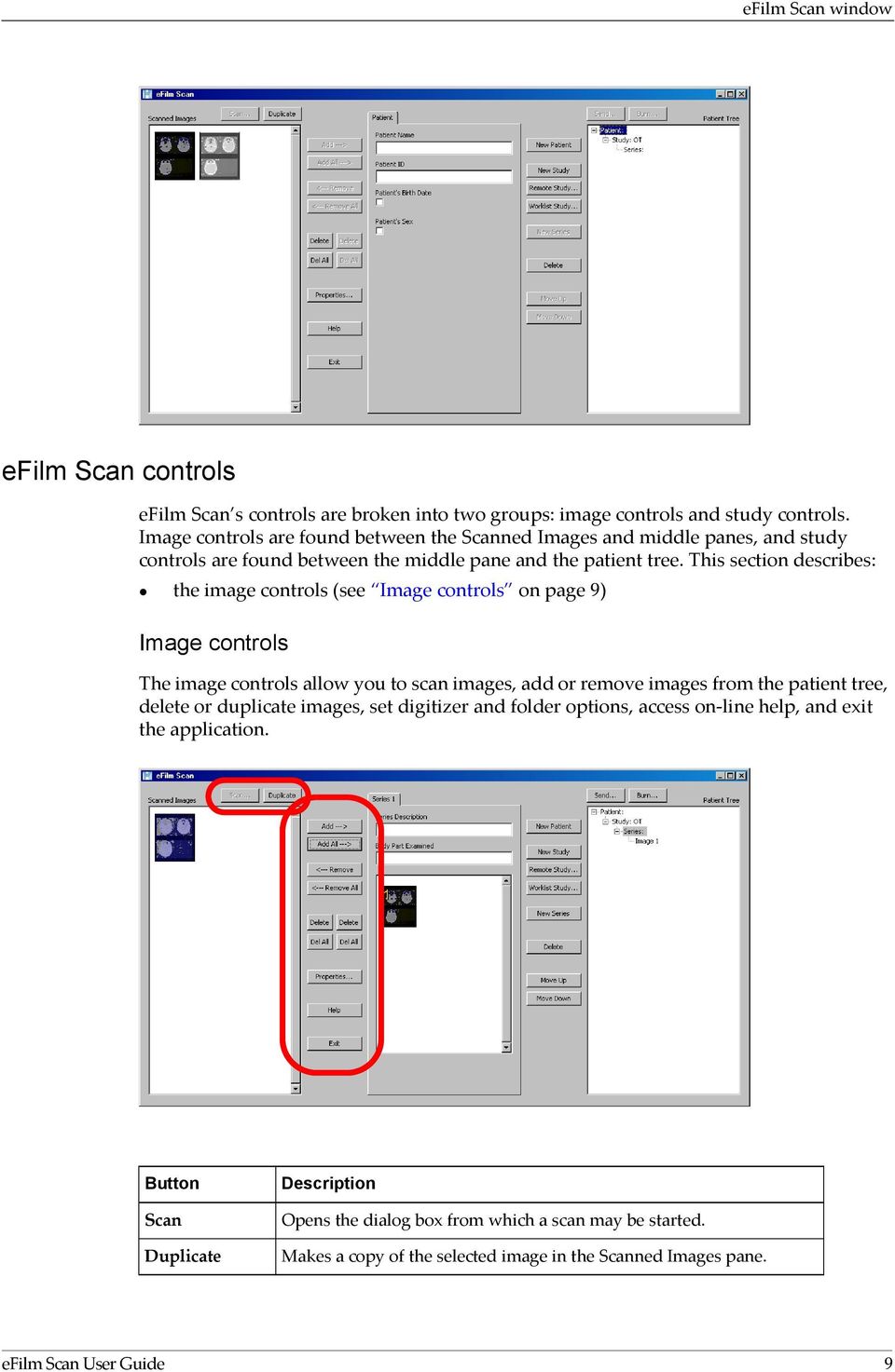 This section describes: the image controls (see Image controls on page 9) Image controls The image controls allow you to scan images, add or remove images from the patient tree,