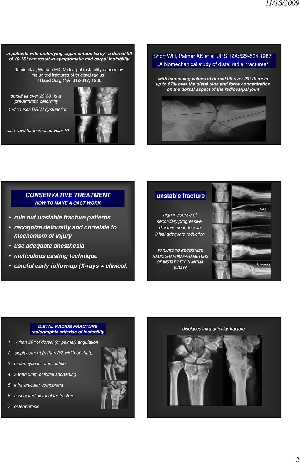 J Hand Surg 11A: 812-817, 817, 1986 dorsal tilt over 20-30 30 is a pre-arthrotic deformity and causes DRUJ dysfunction Short WH, Palmer AK et al JHS 12A:529-534,1987534,1987 A biomechanical study of