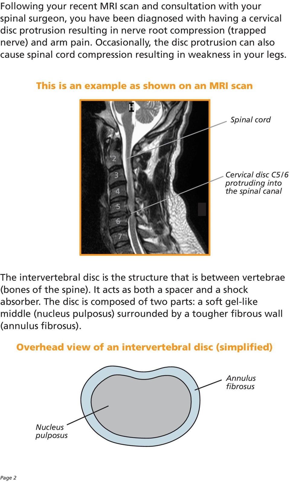 This is an example as shown on an MRI scan Spinal cord 2 3 4 Cervical disc C5 / 6 protruding into the spinal canal 5 6 7 The intervertebral disc is the structure that is between vertebrae (bones of
