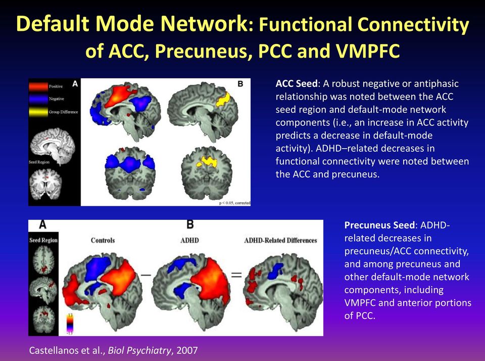 ADHD related decreases in functional connectivity were noted between the ACC and precuneus.