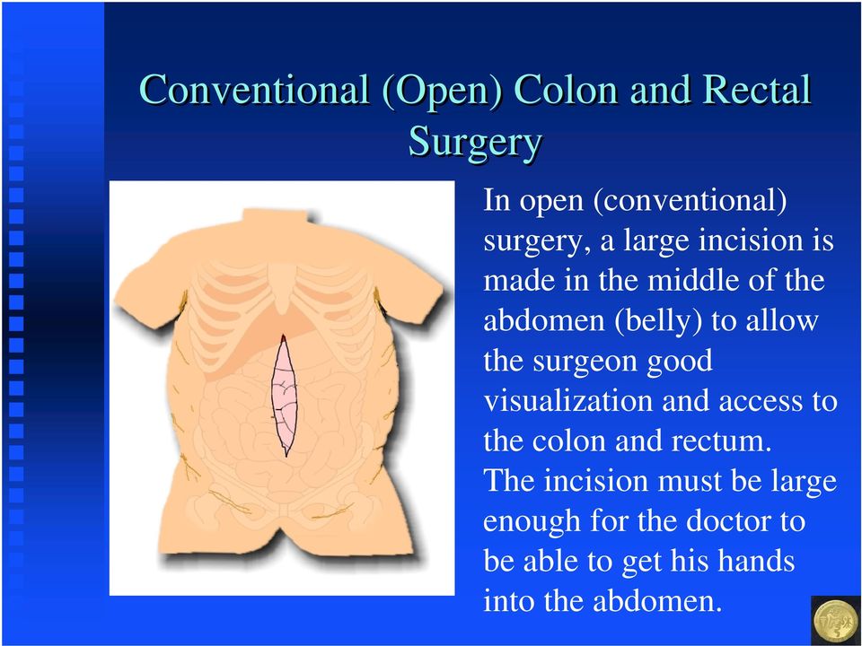 surgeon good visualization and access to the colon and rectum.
