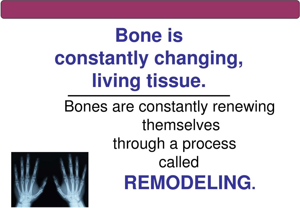 Bones are constantly renewing