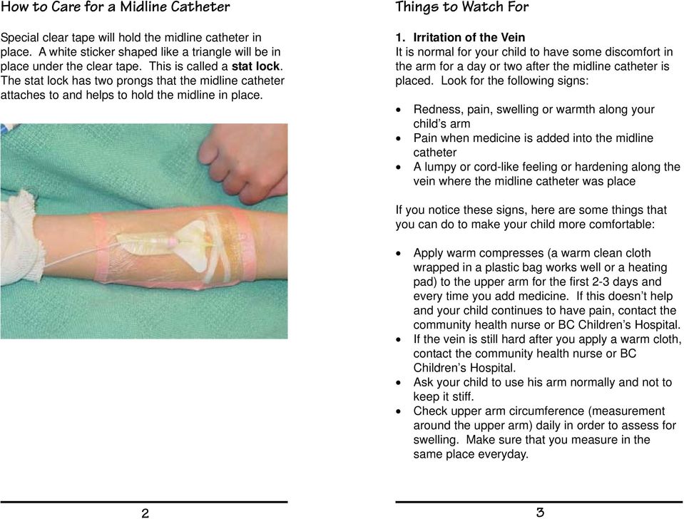 Irritation of the Vein It is normal for your child to have some discomfort in the arm for a day or two after the midline catheter is placed.