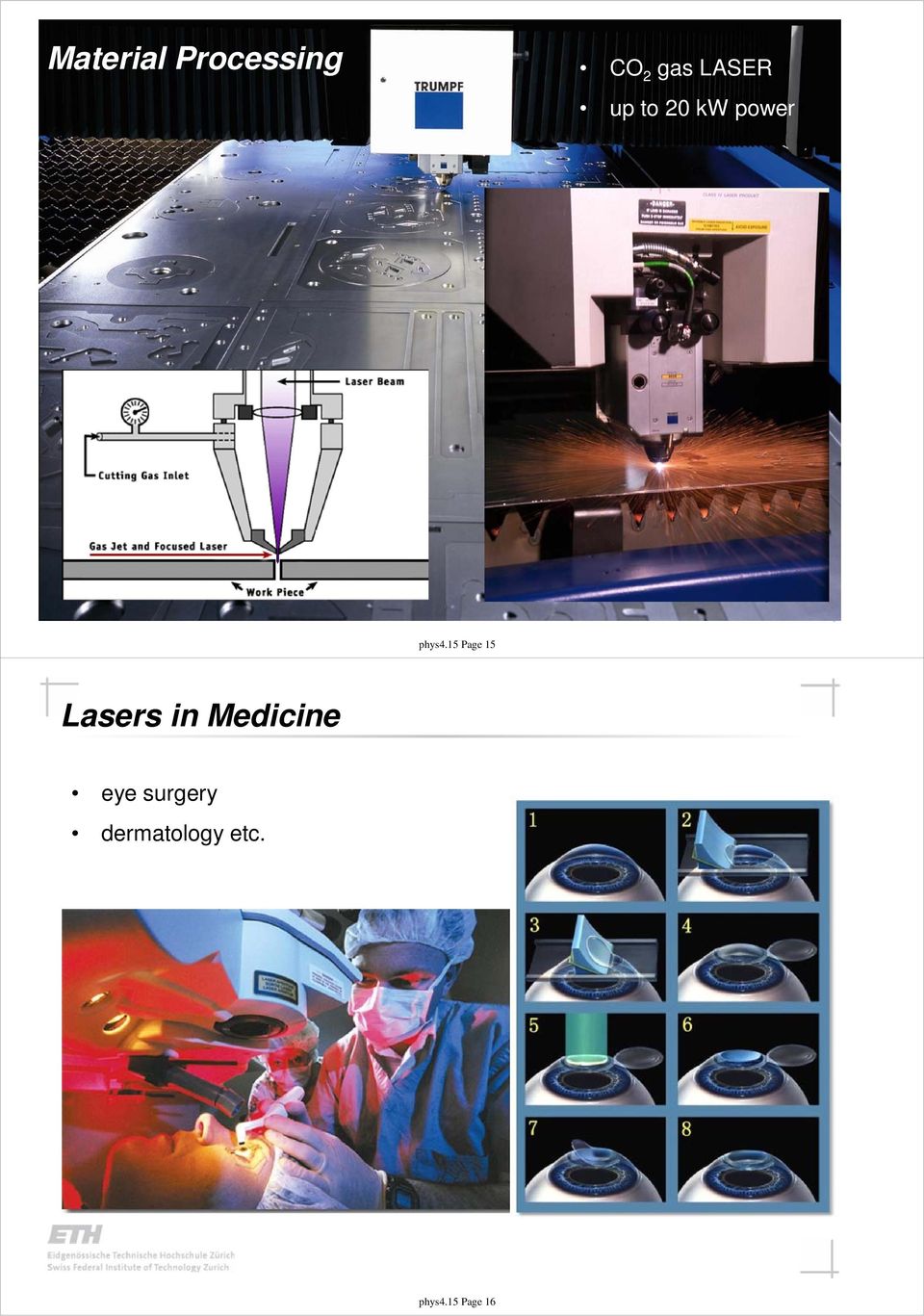 15 Page 15 Lasers in Medicine eye