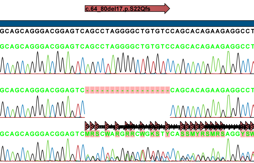SMIM1 Gene Located on chromosome 1p36.
