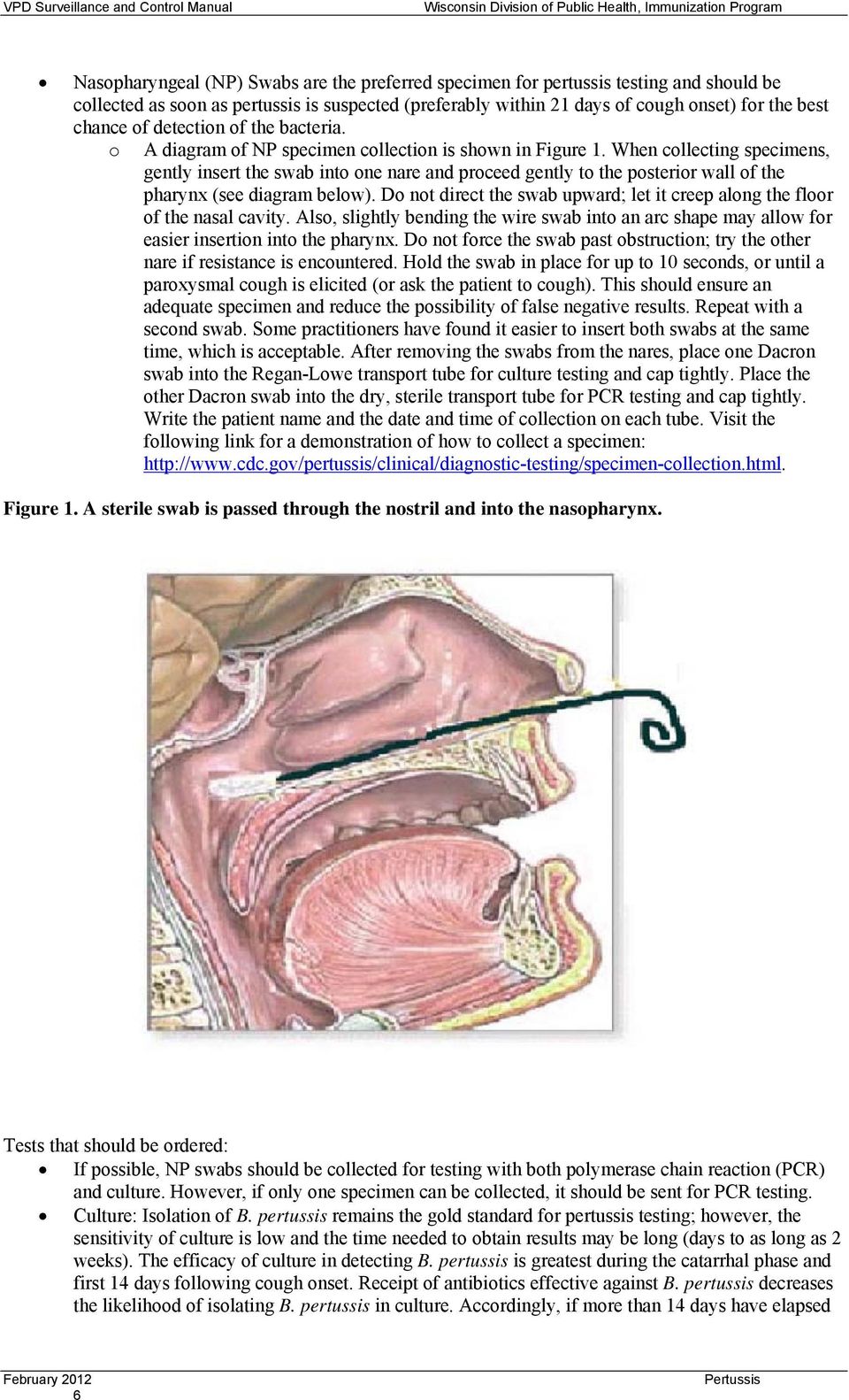 When collecting specimens, gently insert the swab into one nare and proceed gently to the posterior wall of the pharynx (see diagram below).
