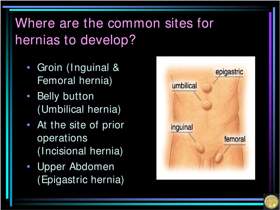 (Umbilical hernia) At the site of prior operations