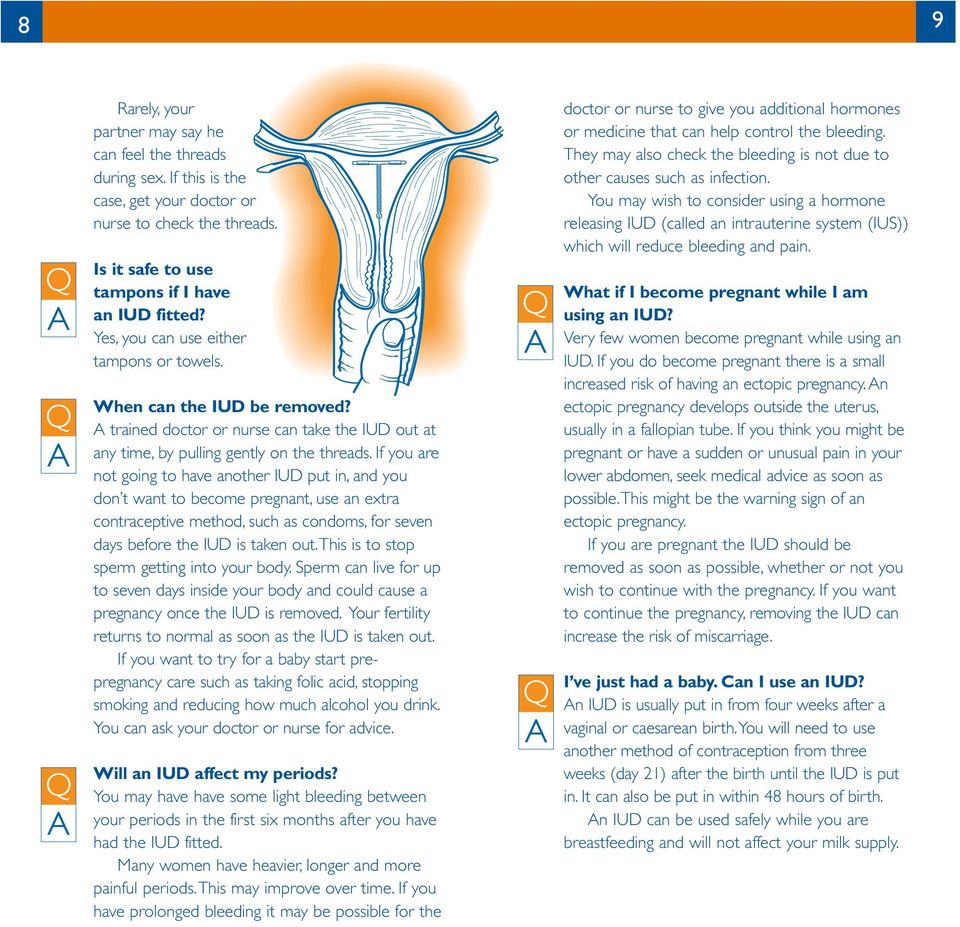 If you are not going to have another IUD put in, and you don t want to become pregnant, use an extra contraceptive method, such as condoms, for seven days before is taken out.