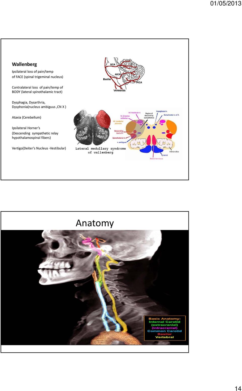 Dysarthria, Dysphonia(nucleus ambiguus,cn X ) Ataxia (Cerebellum) Ipsilateral Horner s
