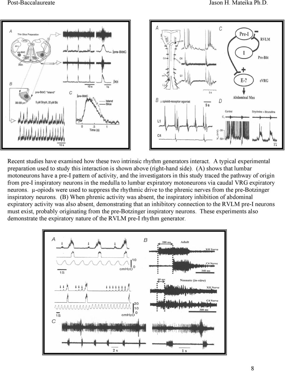 motoneurons via caudal VRG expiratory neurons. µ-opiods were used to suppress the rhythmic drive to the phrenic nerves from the pre-botzinger inspiratory neurons.