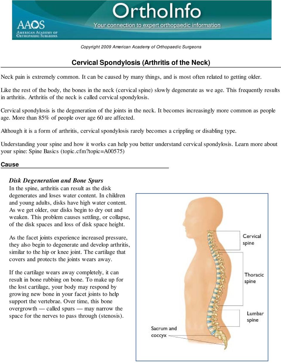 This frequently results in arthritis. Arthritis of the neck is called cervical spondylosis. Cervical spondylosis is the degeneration of the joints in the neck.