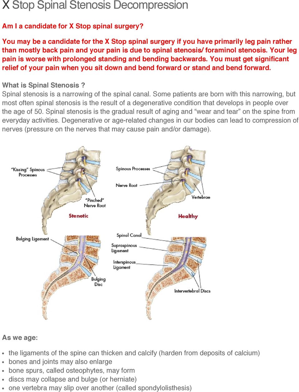 Your leg pain is worse with prolonged standing and bending backwards. You must get significant relief of your pain when you sit down and bend forward or stand and bend forward.