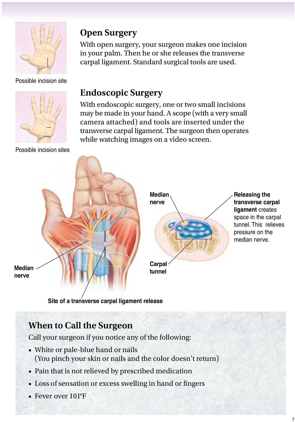 A scope (with a very small camera attached) and tools are inserted under the transverse carpal ligament. The surgeon then operates while watching images on a video screen.