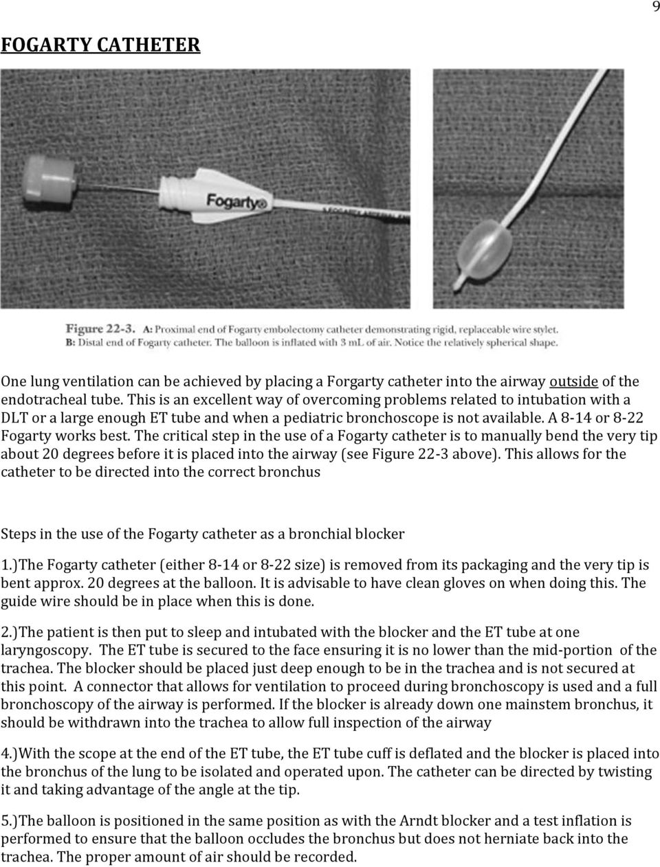 The critical step in the use of a Fogarty catheter is to manually bend the very tip about 20 degrees before it is placed into the airway (see Figure 22-3 above).