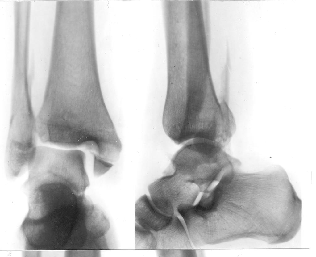 reparația articulațiilor și tendoanelor tratamentul durerii articulare Preț