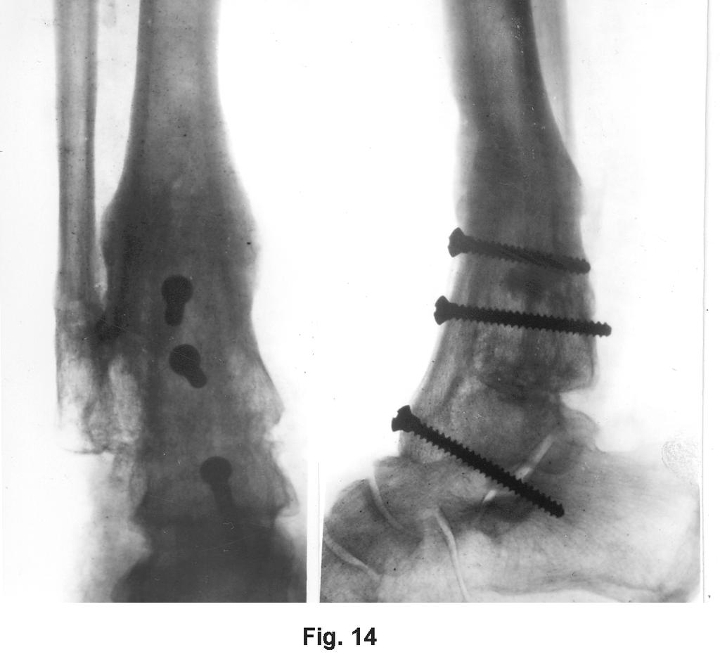 dureri de genunchi online durere sub tratamentul articulației genunchiului