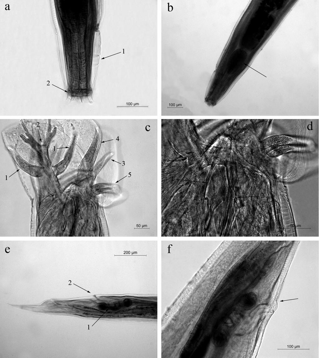 Fig. 1. Morphologic features of Oesophagostomum dentatum in materials from wild boars from Bulgaria.