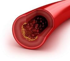 183 The body needs cholesterol, but it produces all of the cholesterol that it needs.