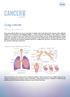 Lung cancer. What is lung cancer?