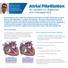 Atrial Fibrillation An update on diagnosis and management