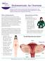 Endometriosis: An Overview