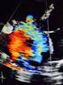 Echocardiography has become the primary imaging