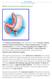 What is the Sleeve Gastrectomy?