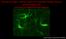 Calming microglia: a future method for treating multiple sclerosis Jarred Younger, PhD University of Alabama at Birmingham