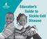 Educator s Guide to Sickle Cell Disease