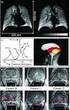 Molecular Imaging and Prostate Cancer
