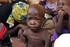 Child malnutrition IN NORTHERN NIGERIA: An Illustrative Case Study