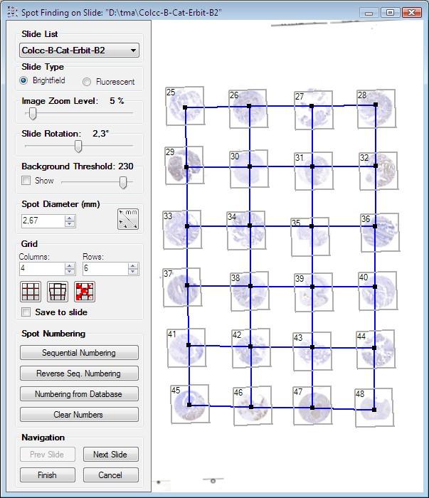 3 Setting up a TMA Project If the spot map is regular without any rows or column of spots missing and the numbering starts from the upper left corner of a TMA slide, select Sequential Numbering.