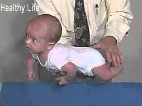 Gross motor development: Head Control Newborn: Head lag on pulling to sit, head extension in ventral position.
