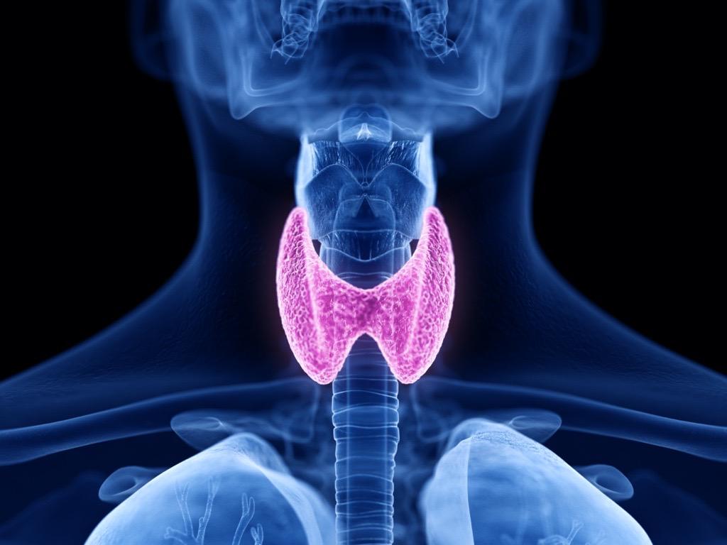 Stephanie L Lee MD. Hashimoto thyroiditis. Practice Essentials, Background, Etiology. https://emedicine.medscape.com/article/120937-overview#a1. Published August 12, 2022. Accessed August 20, 2022.