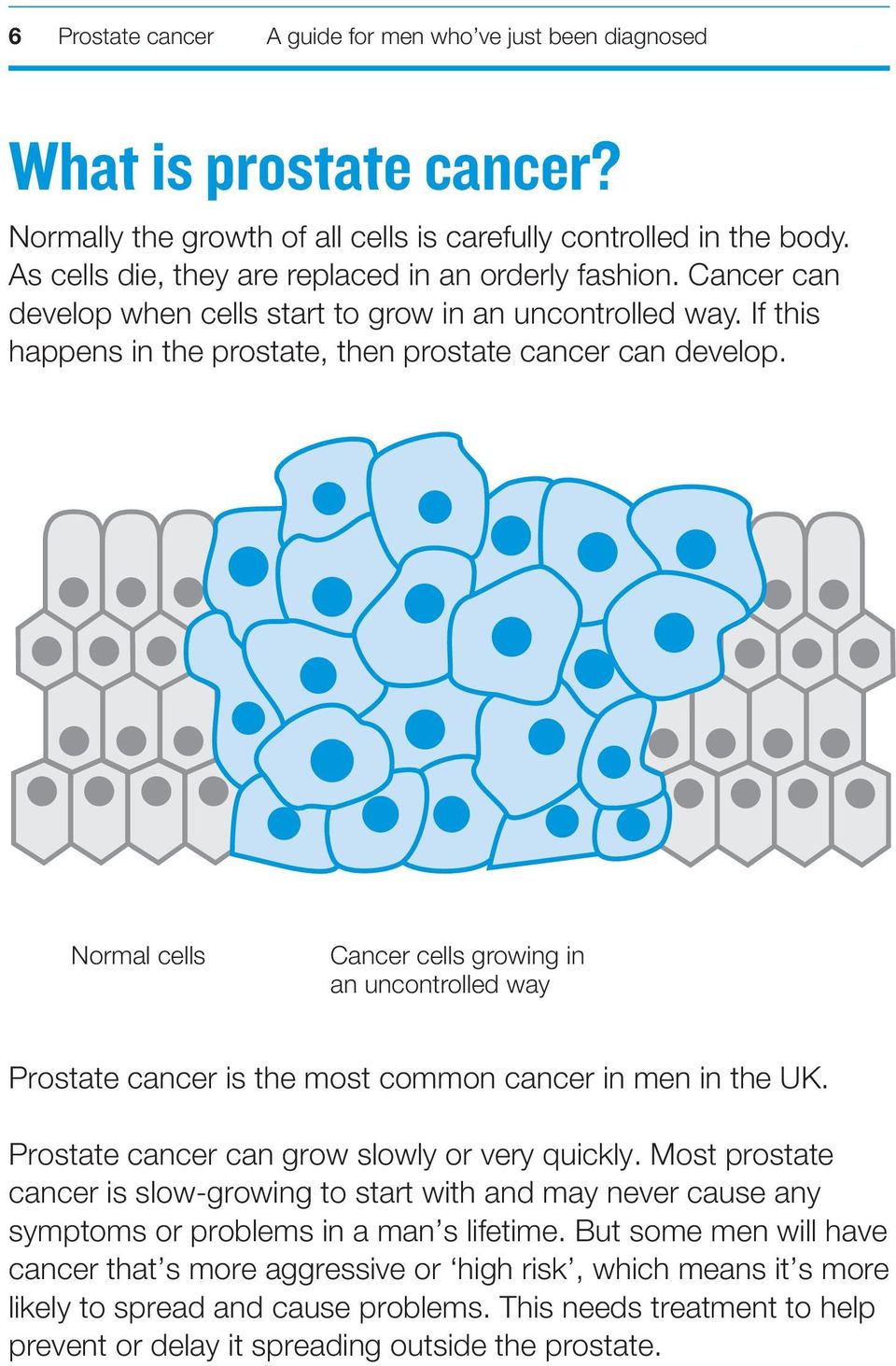 Normal cells Cancer cells growing in an uncontrolled way Prostate cancer is the most common cancer in men in the UK. Prostate cancer can grow slowly or very quickly.