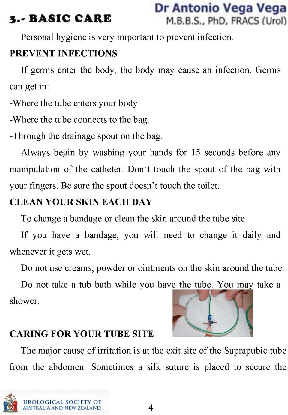 Always begin by washing your hands for 15 seconds before any manipulation of the catheter. Don t touch the spout of the bag with your fingers. Be sure the spout doesn t touch the toilet.