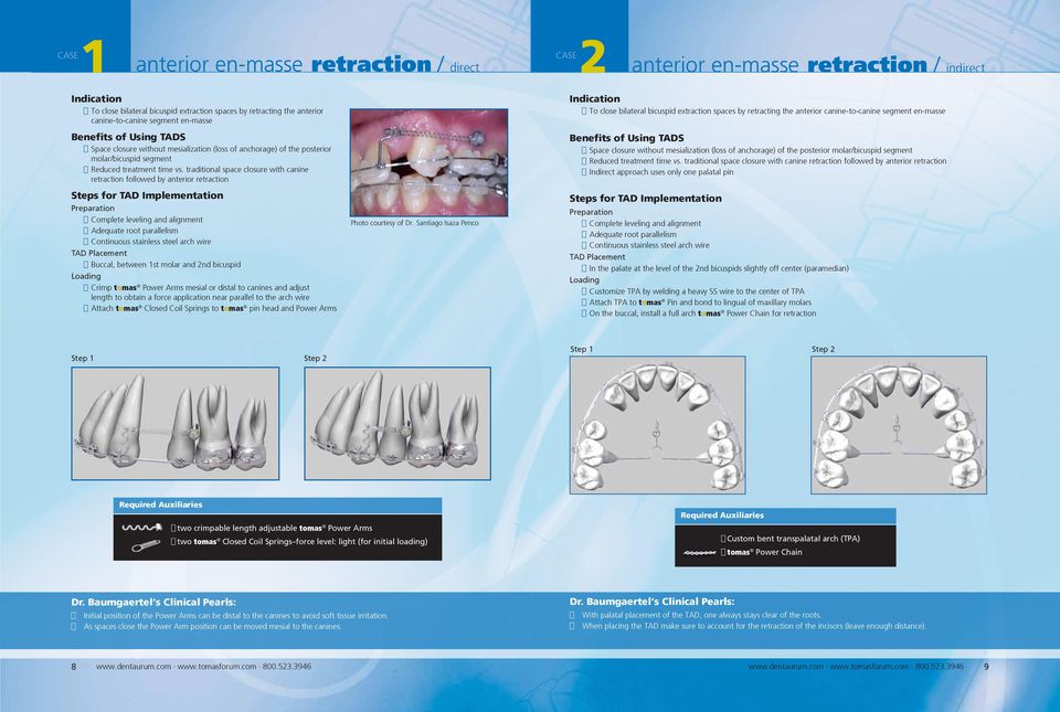 traditional space closure with canine retraction followed by anterior retraction Buccal, between 1st molar and 2nd bicuspid Crimp tomas Power Arms mesial or distal to canines and adjust length to